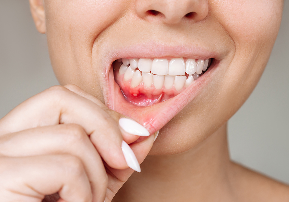 Closeup of a woman dealing with dental issue