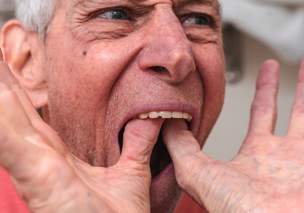 Man fitting top row of dentures in his mouth.
