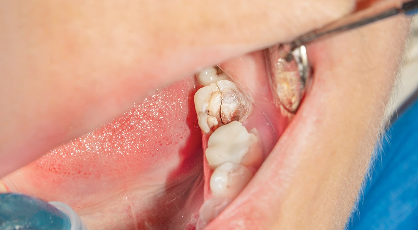Dentist Emergency