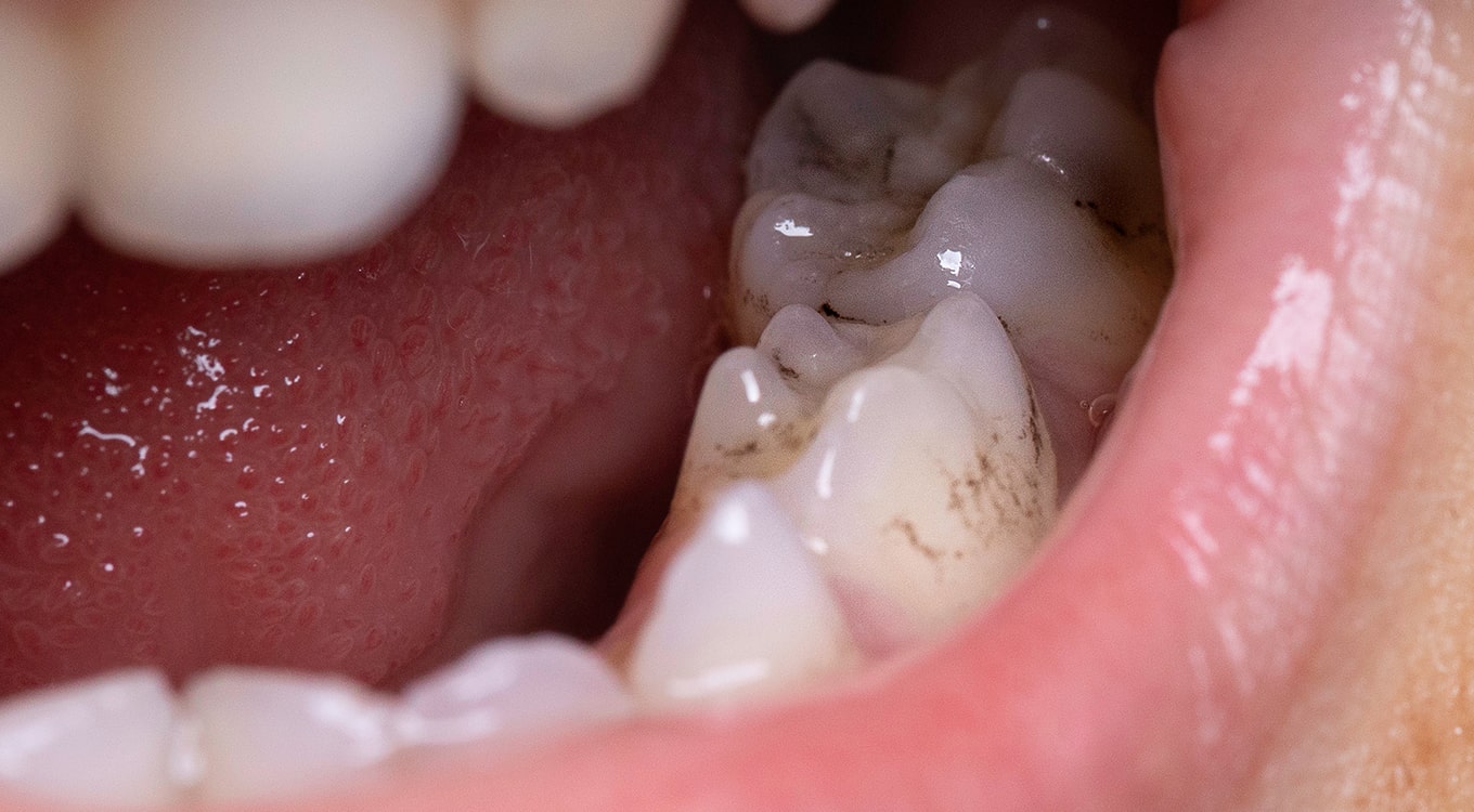 Emergency Dental Services